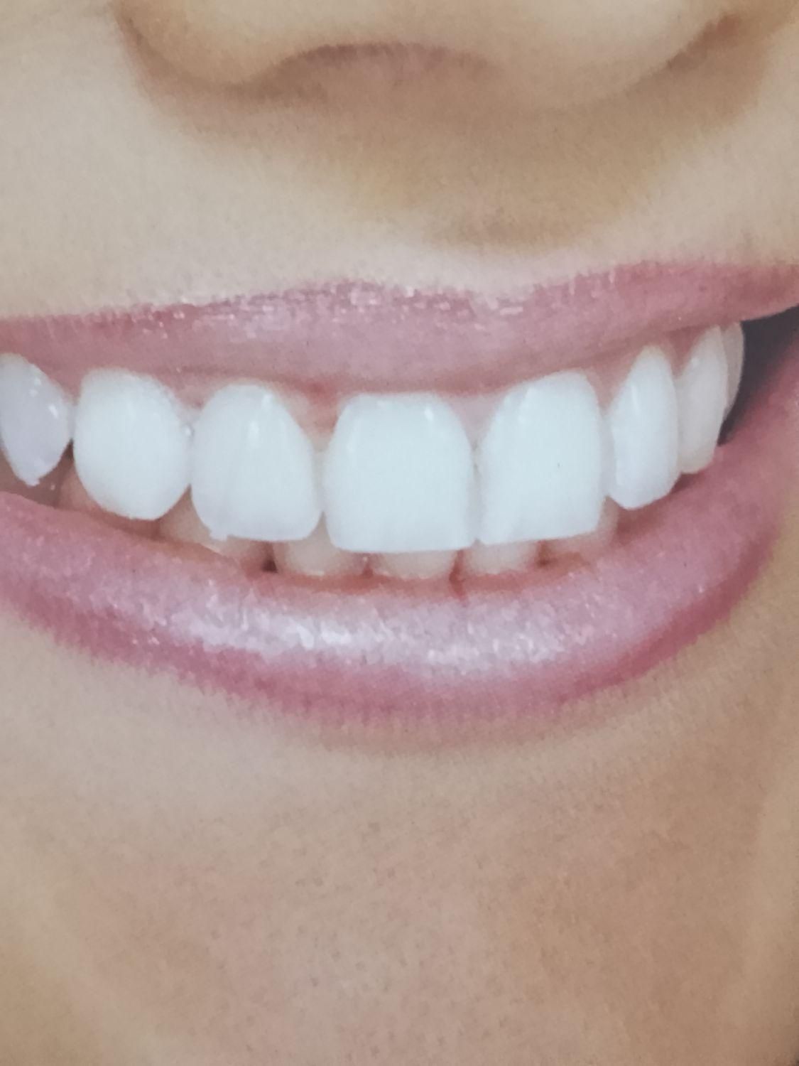 دندانپزشکی و دندانسازی دکتر عزیزاله شجاعی|خدمات آرایشگری و زیبایی|بهبهان, |دیوار