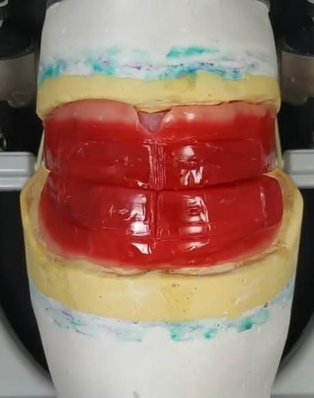 میخای تو 30 جلسه دندانسازی رو آموزش ببینی|خدمات آموزشی|ارومیه, |دیوار