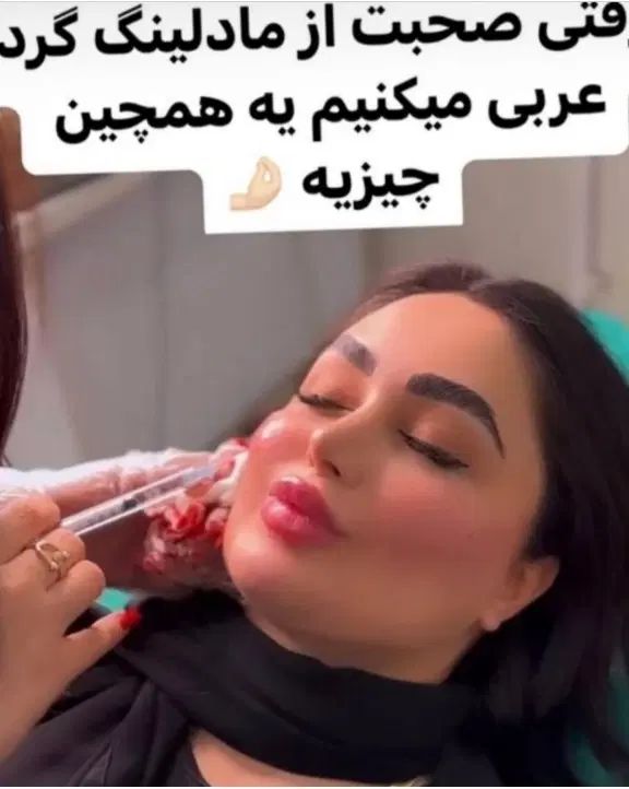 تزریق ژل بوتاکس و ساکشن تزریق چربی درکلینیک|خدمات آرایشگری و زیبایی|کرمانشاه, |دیوار