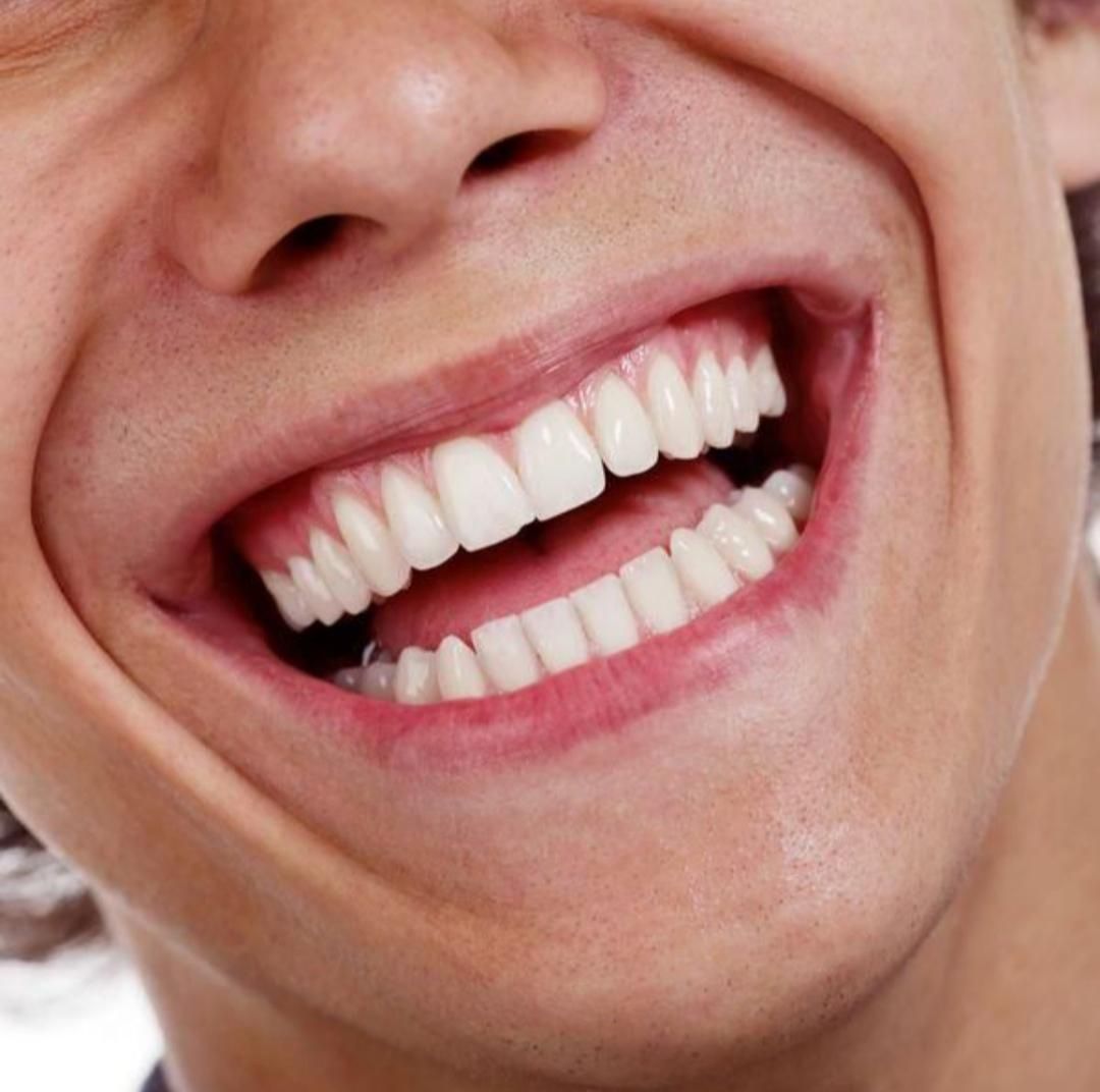 ساخت دندان مصنوعی تحویل ۱روزه (100٪ ضمانتی)|خدمات آرایشگری و زیبایی|یزد, |دیوار