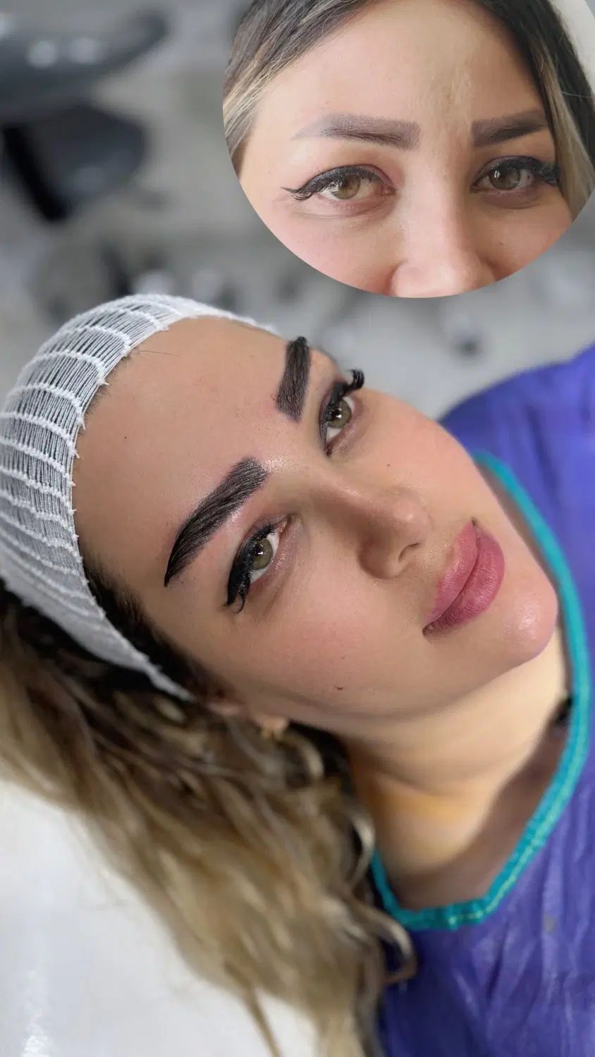 مرکز فوق تخصصی( کاشت مو ۱۴ م/کاشت ابرو ۱۰م)|خدمات آرایشگری و زیبایی|اندیشه, اندیشه فاز ۱|دیوار