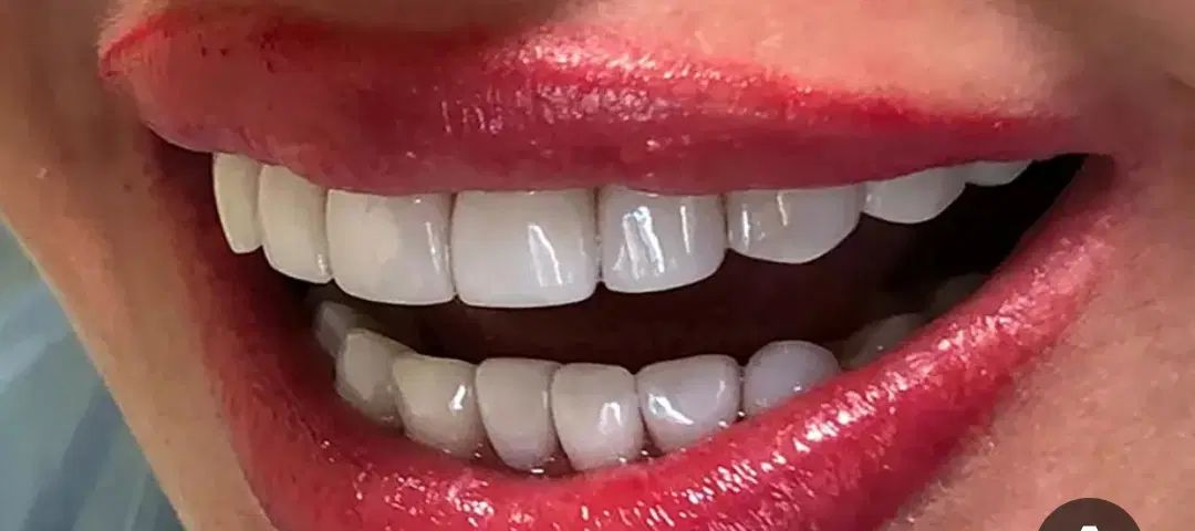 انجام کلیه خدمات دندانپزشکی|خدمات آرایشگری و زیبایی|مشهد, آبکوه|دیوار