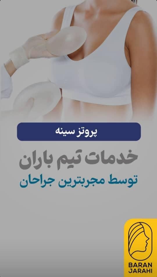 عمل افتادگی پلک / پیکر تراشی/پرداخت اقساطی|خدمات آرایشگری و زیبایی|نورآباد ممسنی, |دیوار