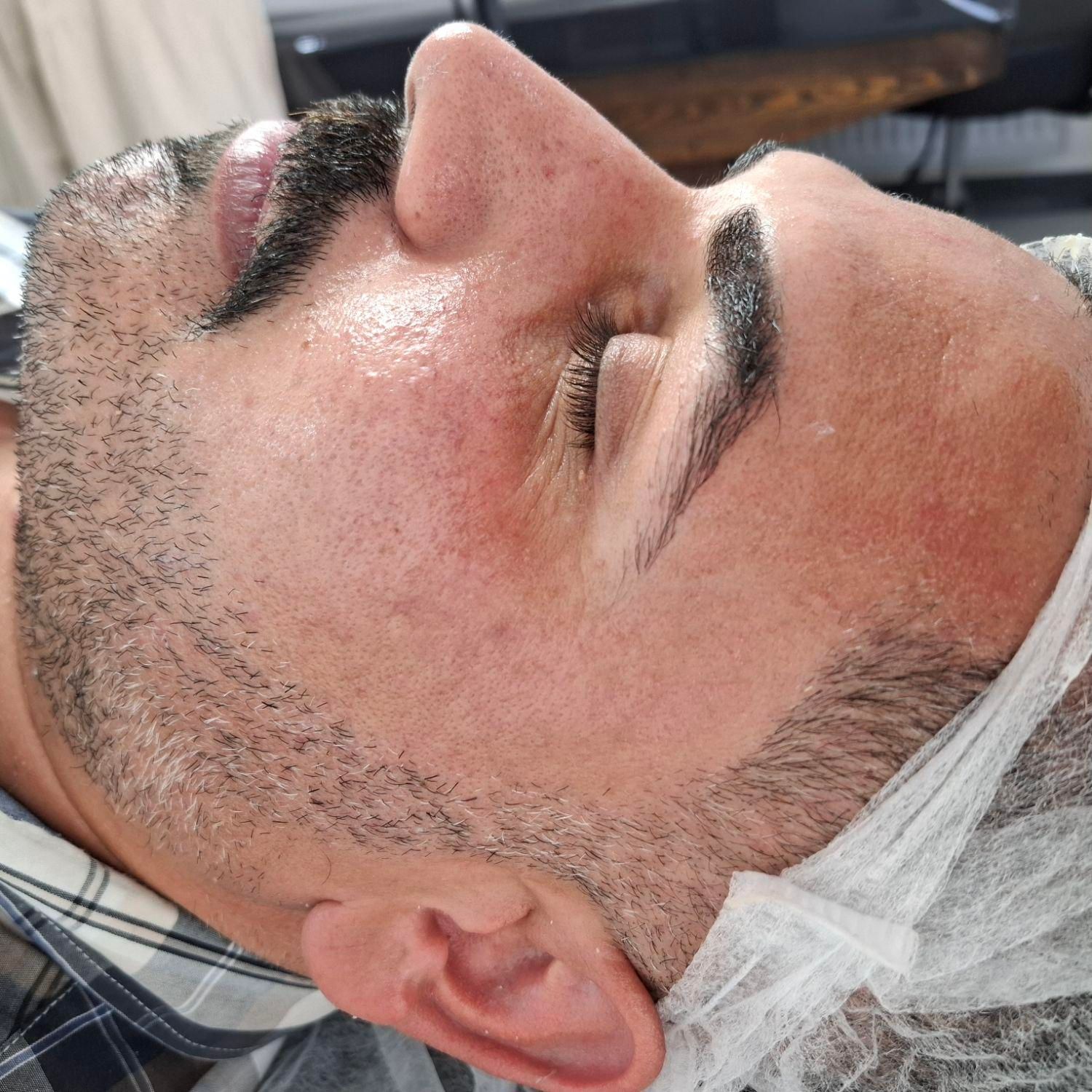 فیشال و پاکسازی پوست|خدمات آرایشگری و زیبایی|اصفهان, دشتستان|دیوار
