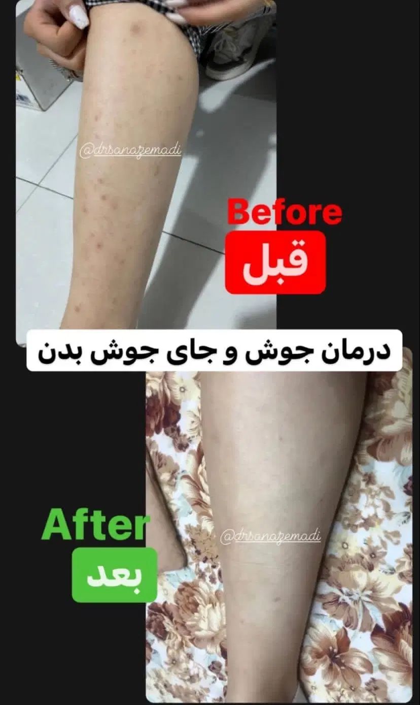 معجزه ۱۴ روزه درخشندگی|آرایشی، بهداشتی، درمانی|تهران, آجودانیه|دیوار