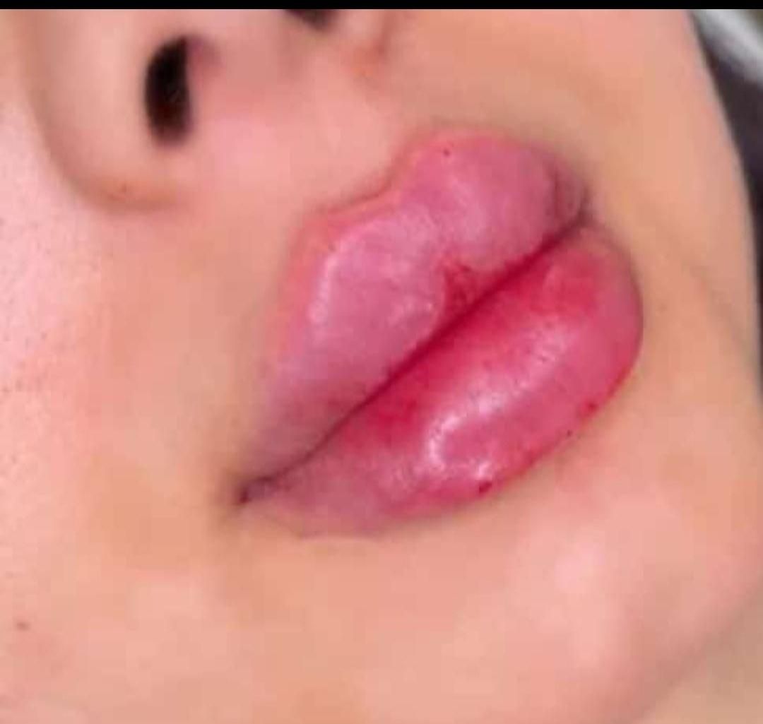 ژل لب و بوتاکس  مدلینگ پرسینگ چالگونه آموزش ژل|خدمات آرایشگری و زیبایی|اهواز, کیانپارس |دیوار