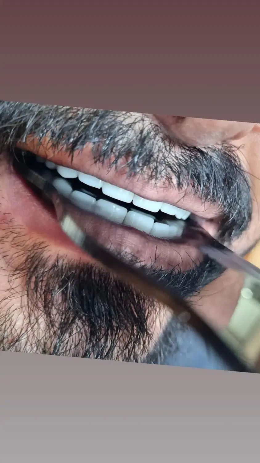 null