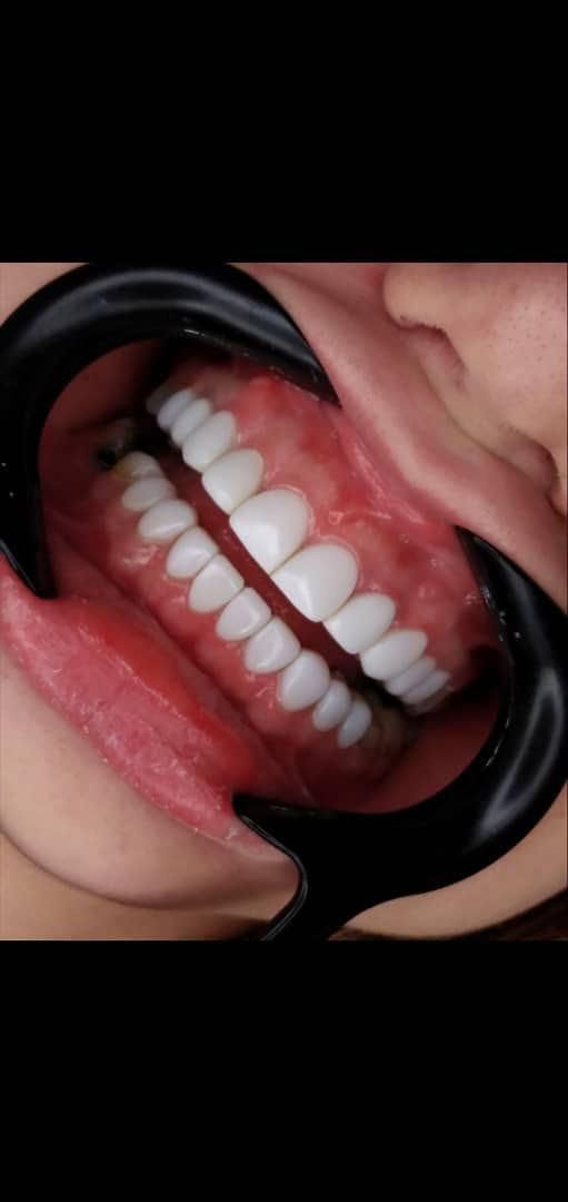 دندانپزشکی،درمان ریشه، جراحی عقل و ترمیم(اقساطی)|خدمات آرایشگری و زیبایی|قم, شهر قائم|دیوار