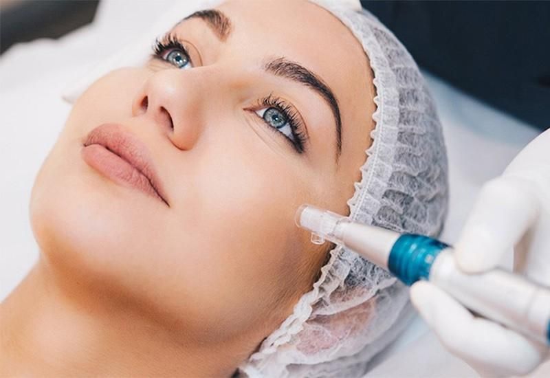 میکرونیدلینگ پوست صورت (مطب دکتر علی بابایی)|خدمات آرایشگری و زیبایی|شهرکرد, |دیوار