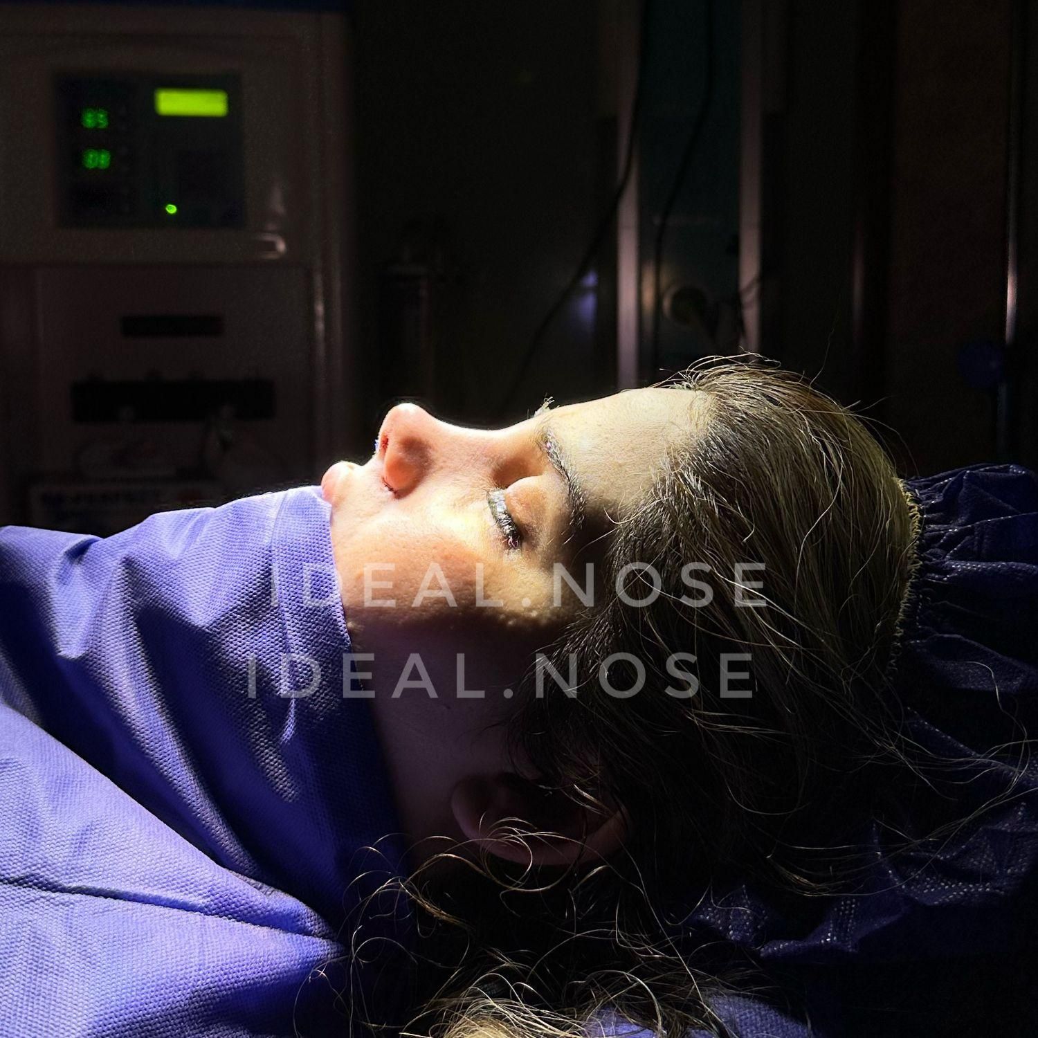 تخفیف ویژە عمل بینی(جشنوارە )|خدمات آرایشگری و زیبایی|نیشابور, خیام|دیوار