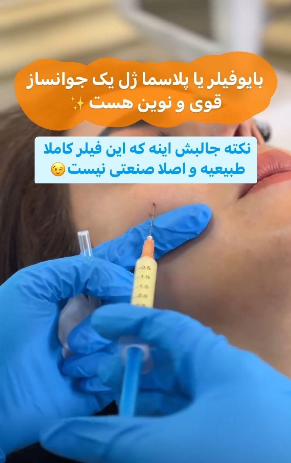 پی آر پی و بایو فیلر با قیمت و جوابدهی عالی|خدمات آرایشگری و زیبایی|فردیس, طالقانی|دیوار