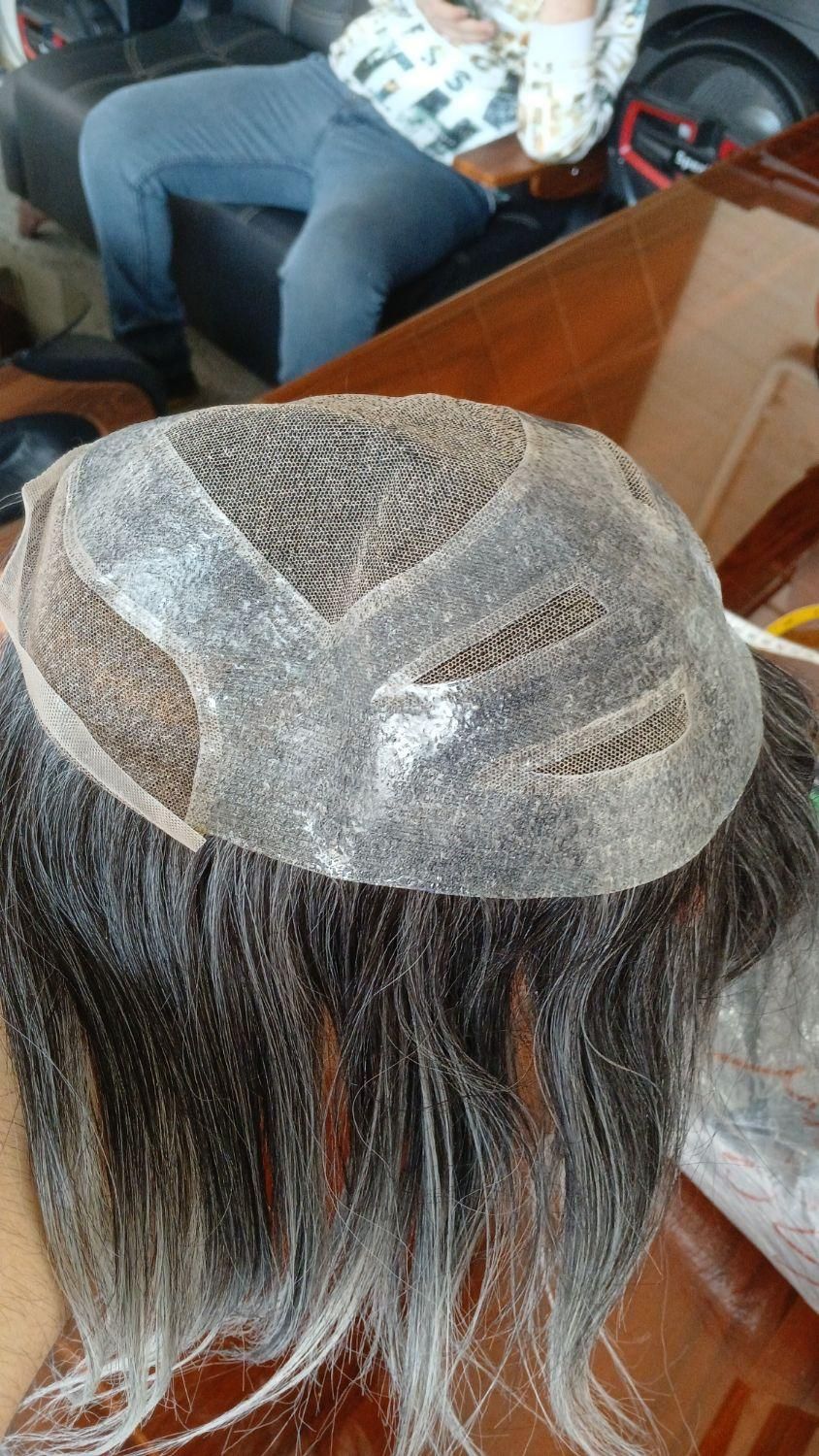 پروتز موی مردانه|آرایشی، بهداشتی، درمانی|تبریز, |دیوار