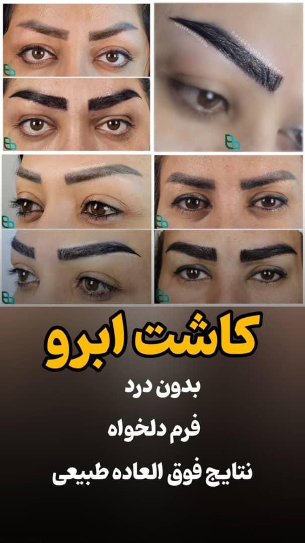 همه جراحی های زیبایی باشرایط اقساط و وام بدون ضامن|خدمات آرایشگری و زیبایی|تهران, فلسطین (میدان انقلاب)|دیوار