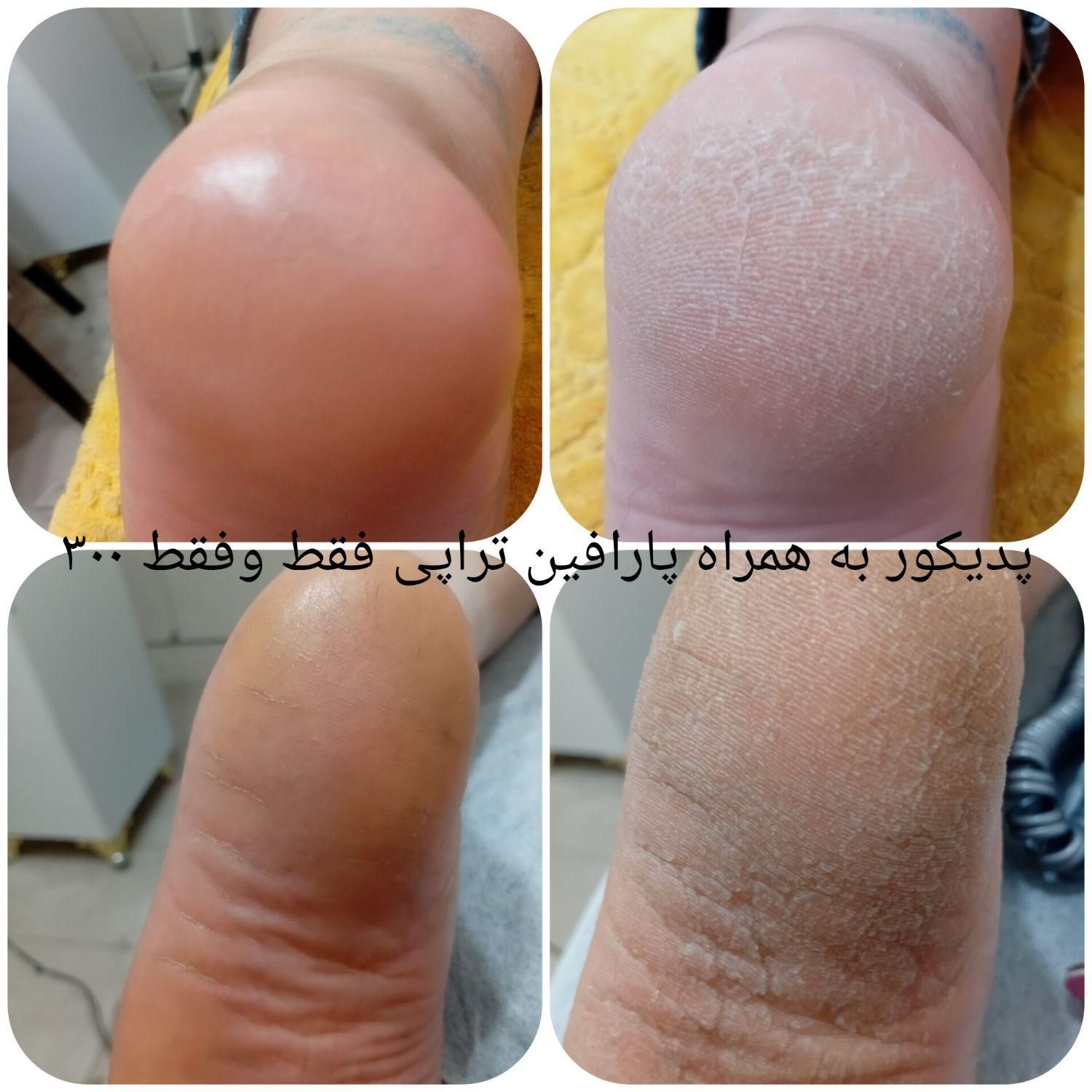 پدیکور(کفسابی پا به همراه پارافین تراپی)|خدمات آرایشگری و زیبایی|اصفهان, هفتون|دیوار