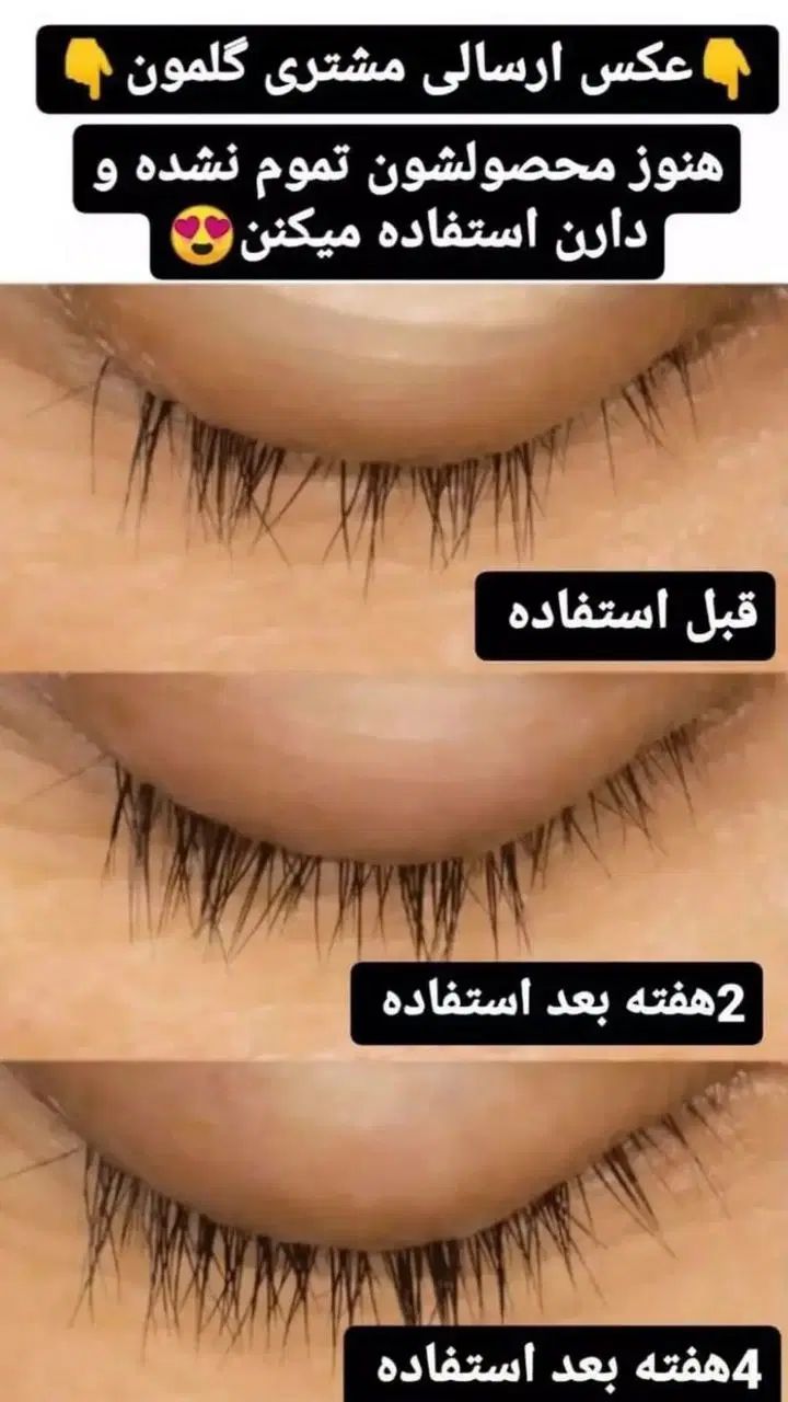 چشمتات کوچیک نیست فقط مژه هات کوچیکه|آرایشی، بهداشتی، درمانی|کرج, شهرک فرهنگیان|دیوار