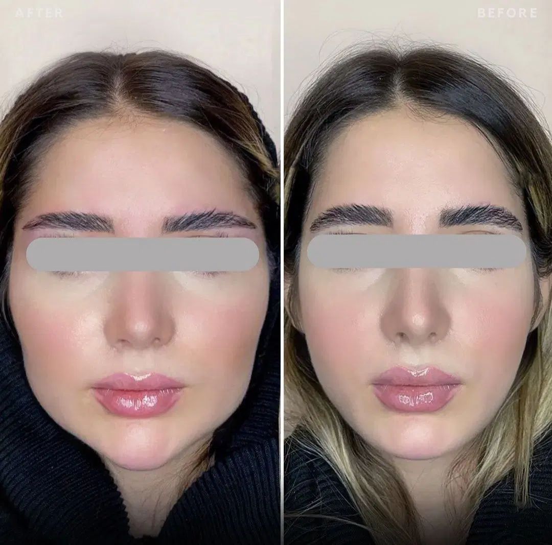 تخفیف ژل و بوتاکس و مزوتراپی و تزریق چربی|خدمات آرایشگری و زیبایی|صدرا-فارس, فاز ۱|دیوار