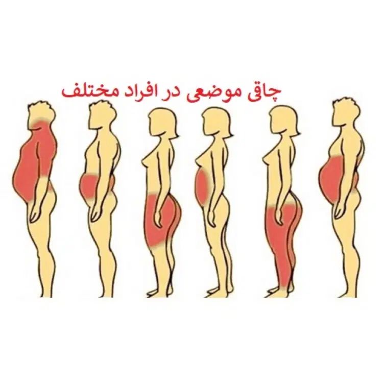 رویداد اجتماعی داوطلبان چاقی و لاغری|فعالیت داوطلبانه|قم, زنبیل آباد|دیوار