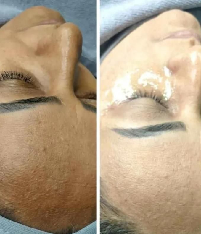 فیشال(پاکسازی) اقتصادی صورت vip|خدمات آرایشگری و زیبایی|محمدیه-قزوین, |دیوار