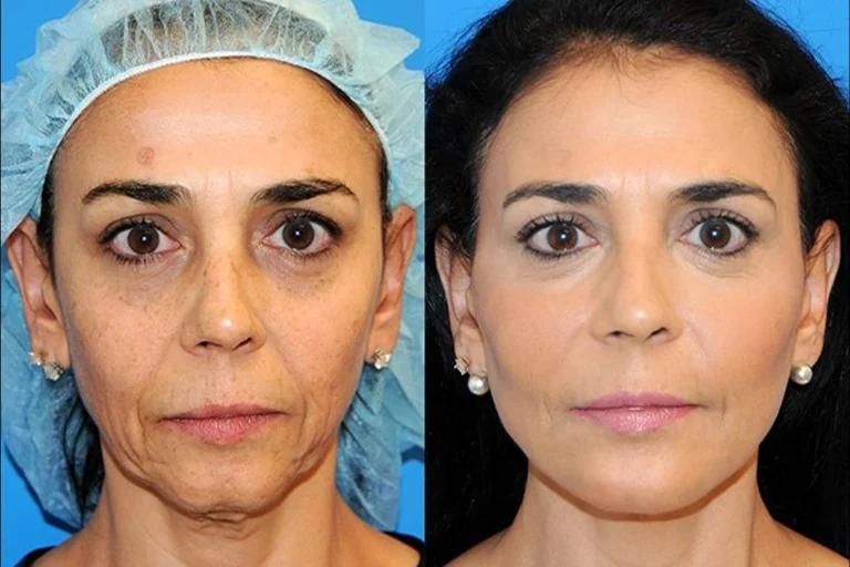 خدمات درمانی و زیبایی|خدمات آرایشگری و زیبایی|تهران, دروس|دیوار