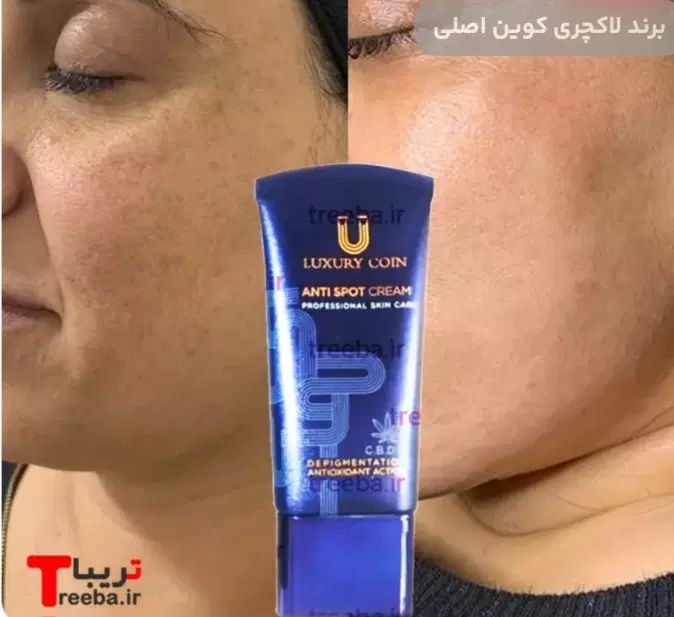 دکتر عباسی مشاوری پوست|آرایشی، بهداشتی، درمانی|تهران, شهرک آزادی|دیوار