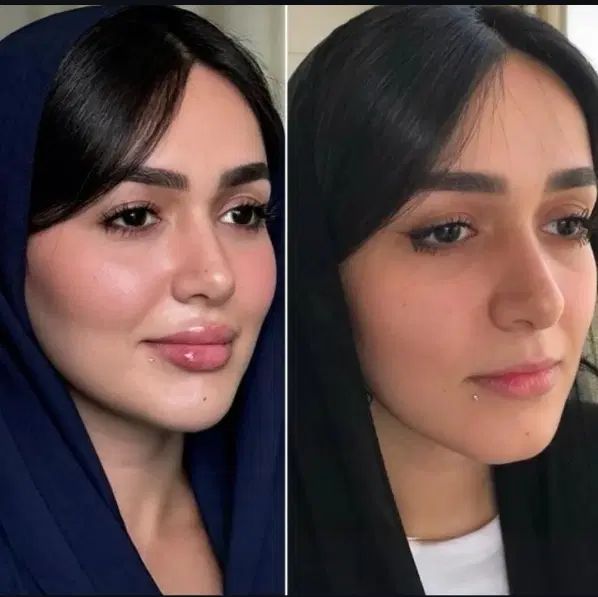 تخفیفات ویژه بوتاکس صورت و فیلر لب،فول فیس و...|خدمات آرایشگری و زیبایی|مشهد, شهید فرامرز عباسی|دیوار