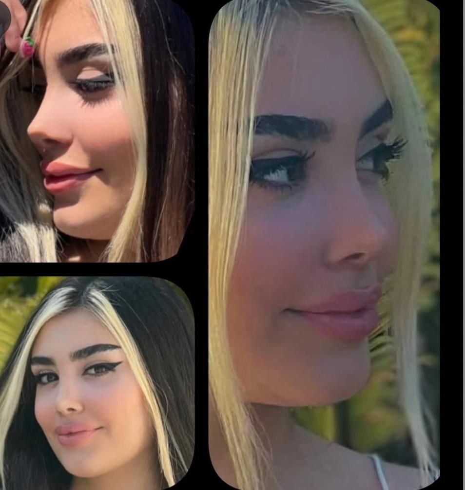 تخفیف عمل جراحی بینی لیفت لیپو ابدو کاشت ابرو مو|خدمات آرایشگری و زیبایی|کرج, عظیمیه|دیوار