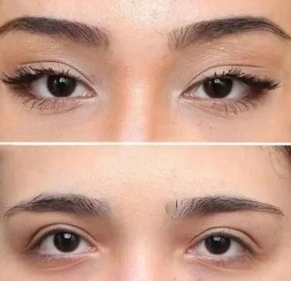 خدمات ژل و بوتاکس پلکسر و...|خدمات آرایشگری و زیبایی|کرمانشاه, |دیوار