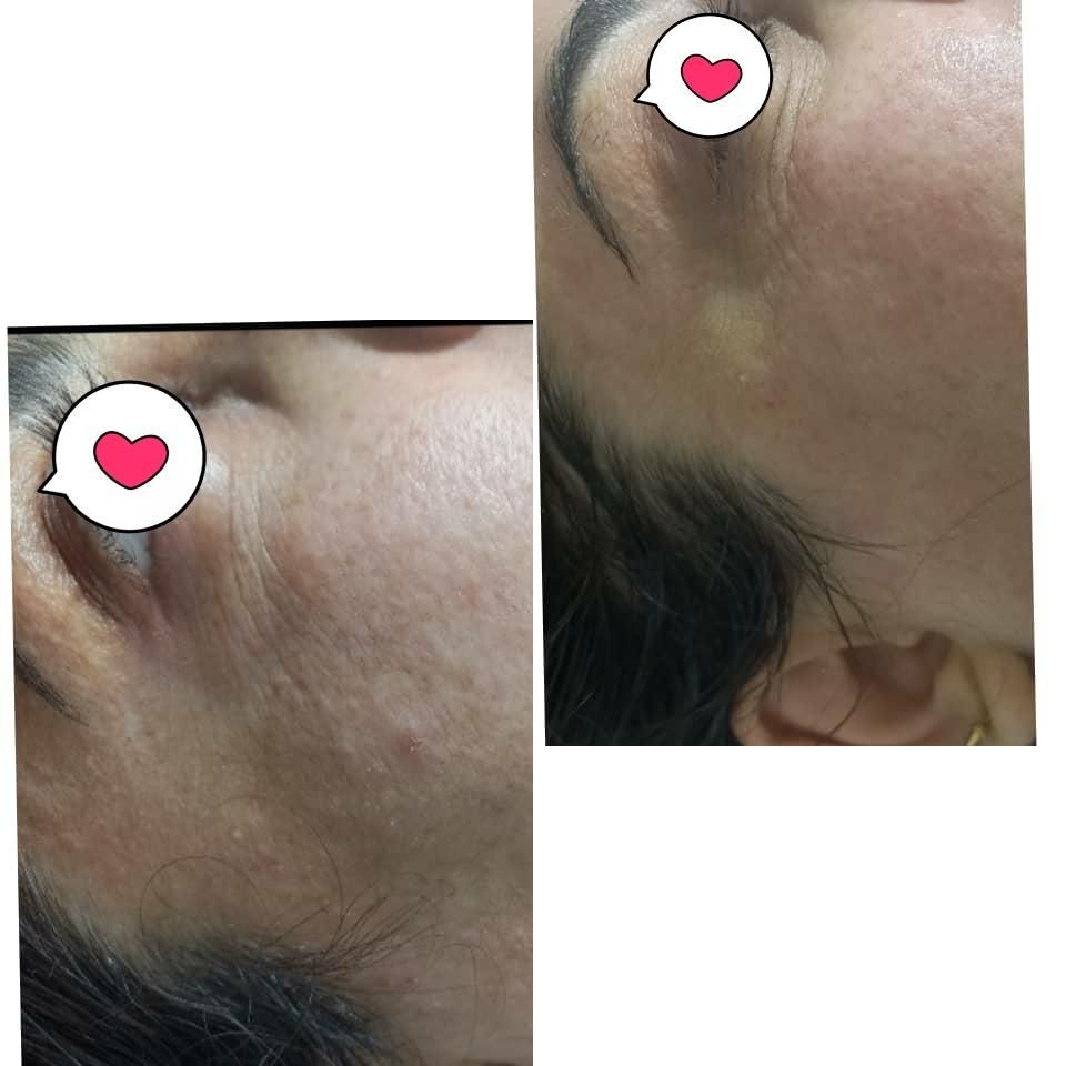 مرکز زیبایی نوژا (تخفیف پلاژن تراپی و میکروکارنت )|خدمات آرایشگری و زیبایی|جهرم, |دیوار