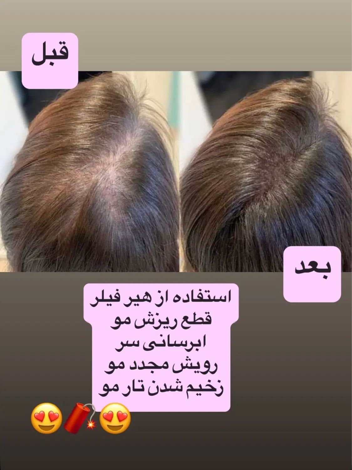 درمان ریزش مو و رویش مجدد با بهترین متریال|خدمات آرایشگری و زیبایی|تهران, امام حسین|دیوار