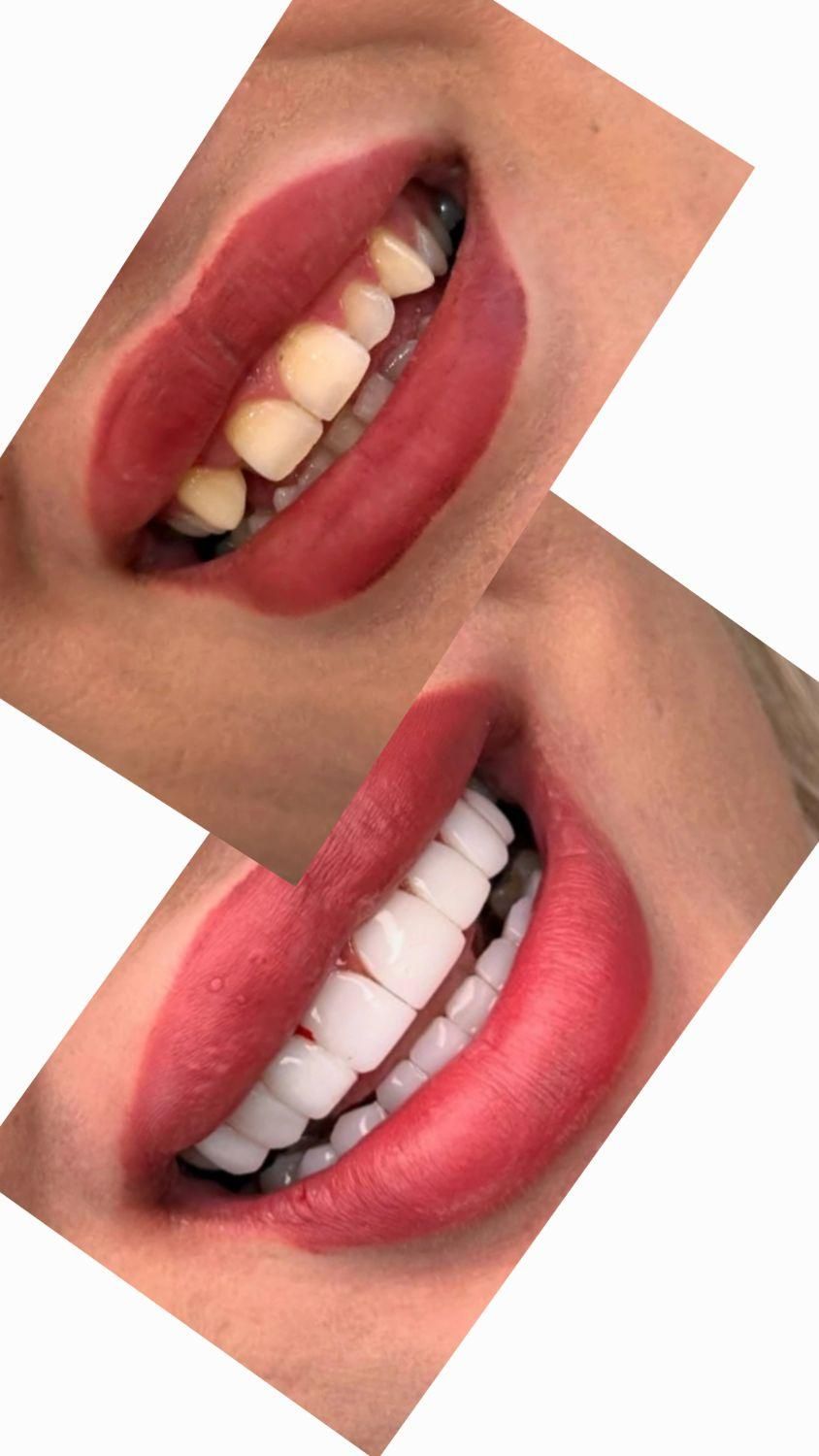 آموزش دندانپزشکی مبحث درمانی|خدمات آموزشی|تهران, شهرک ولیعصر جنوبی|دیوار