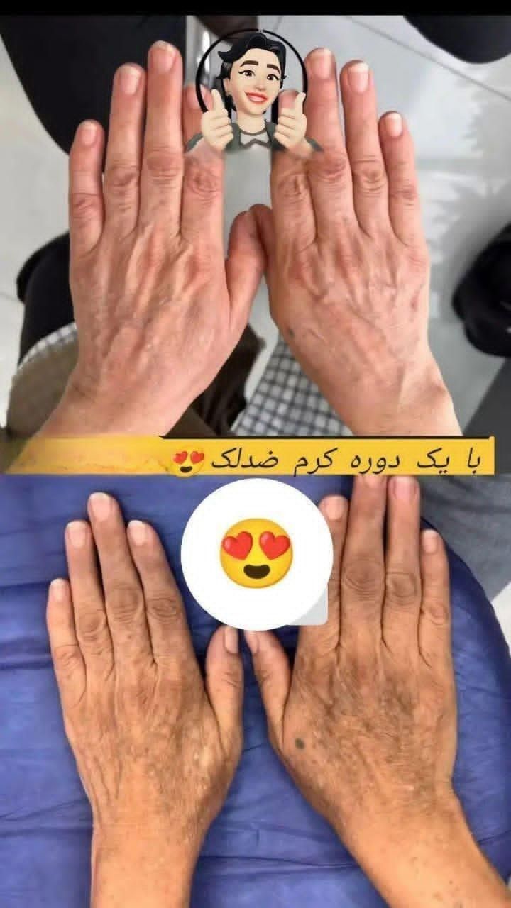 کرم ۸ کاره تضمینی|آرایشی، بهداشتی، درمانی|بندر امام خمینی, |دیوار