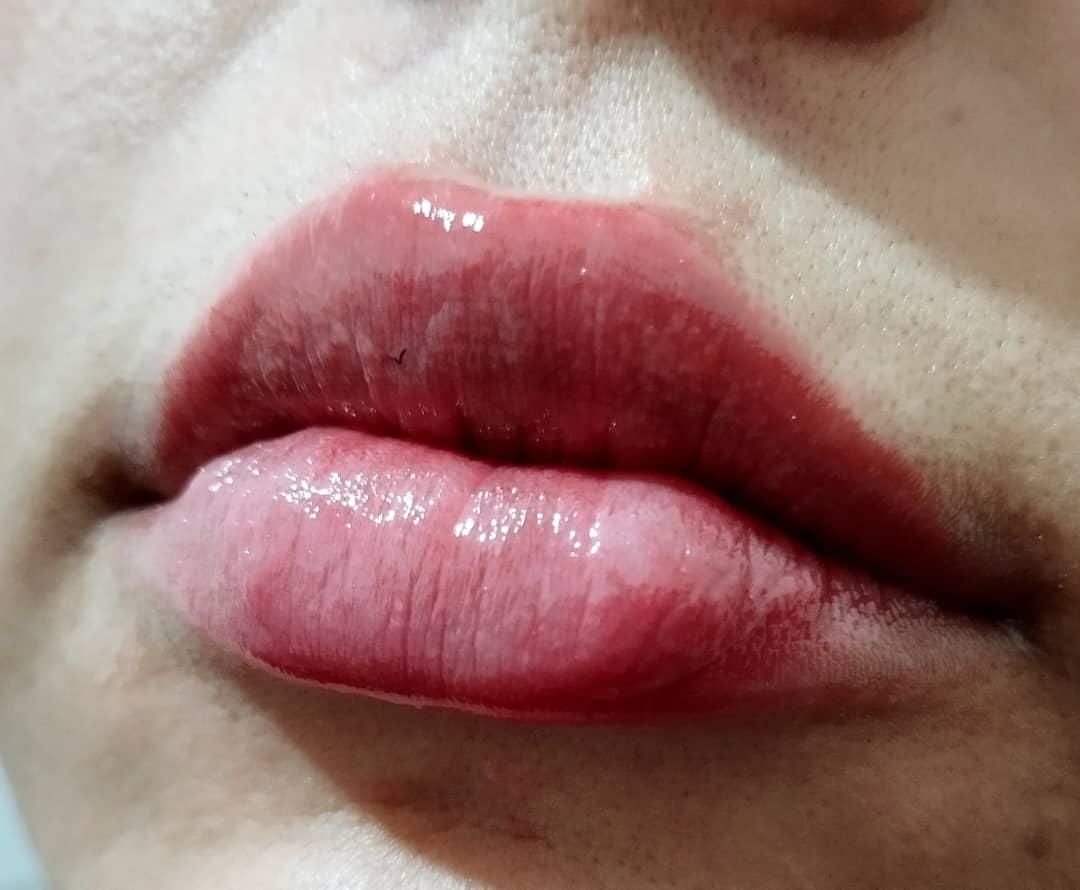 بوتاکس فیلرژل مزو میکروشیدینگ|خدمات آرایشگری و زیبایی|کرج, مشکین‌دشت|دیوار