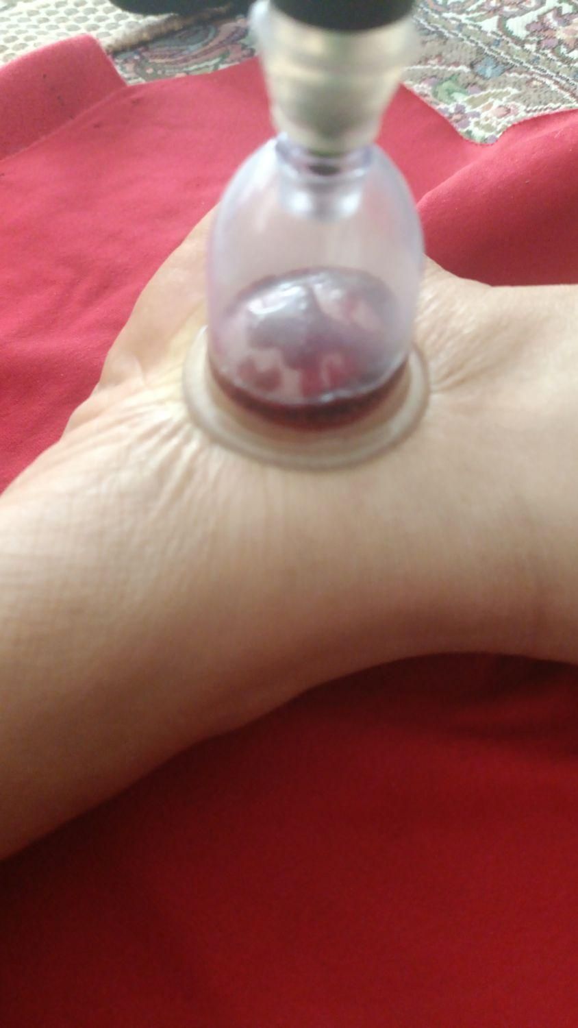 شکسته بندی در کرج و فردیس سیار منزل|خدمات آرایشگری و زیبایی|مشکین‌دشت, |دیوار