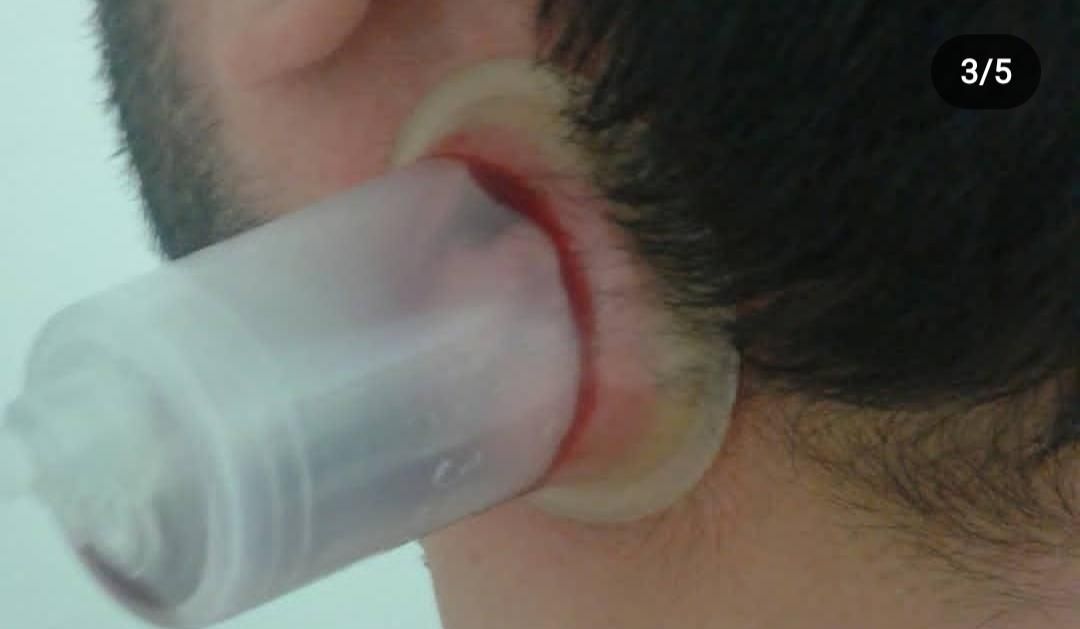 حجامت.زالودرمانی.فصدخون|خدمات آرایشگری و زیبایی|اسلامشهر, شهرک مهدیه|دیوار