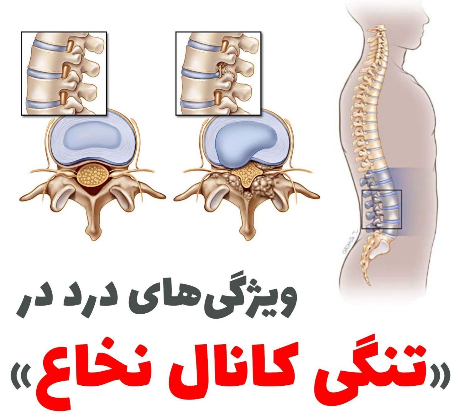 کایروپراکتیک ( بدون نیاز به جراحی )|خدمات آرایشگری و زیبایی|تهران, امام سجاد(ع)|دیوار