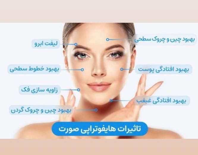 مدل برای هایفوتراپی فقط باقیمت استثنایی 950تومان|خدمات آرایشگری و زیبایی|تبریز, |دیوار