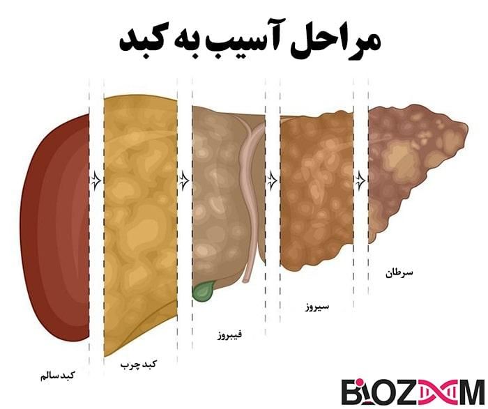 کبدت چربه اگه این علائم رو داری|آرایشی، بهداشتی، درمانی|قم, دانشگاه قم|دیوار