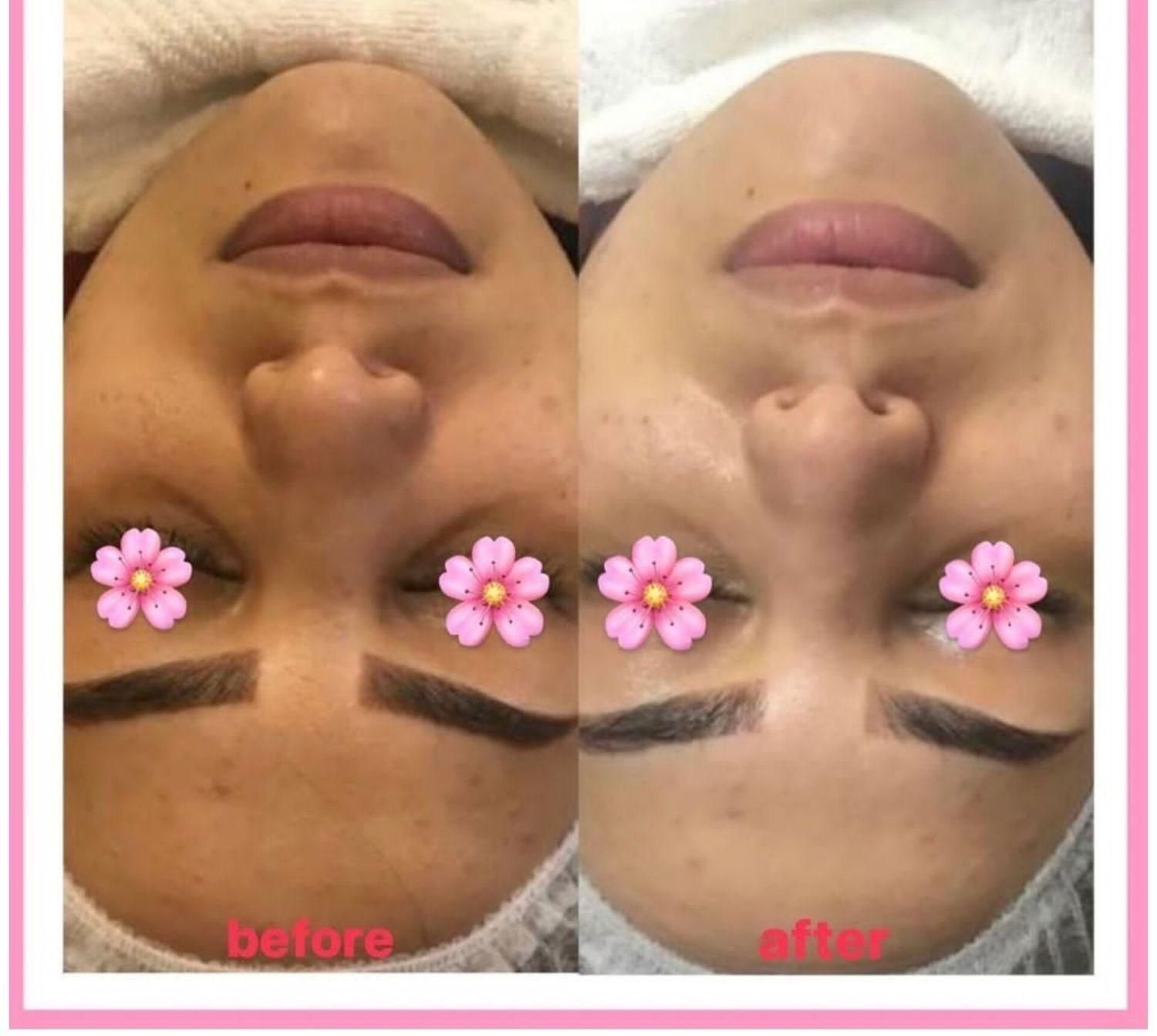 فیشال تخصصی و درمانی قم|خدمات آرایشگری و زیبایی|قم, زنبیل آباد|دیوار