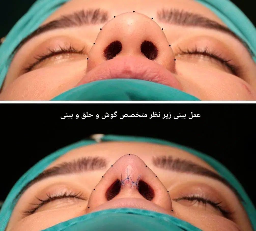 ابدومینوپلاستی.لیپو360.ماموپلاستی .پروتزسینه.بینی|خدمات آرایشگری و زیبایی|تهران, جماران (نیاوران)|دیوار