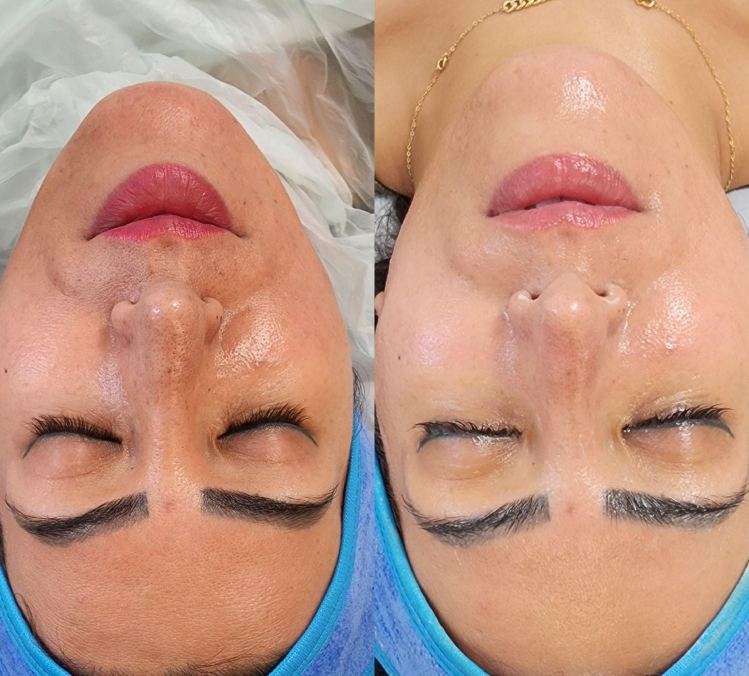 وقت مراقبت از پوستته(پاکسازی،پلاژن تراپی اسیدتراپی|خدمات آرایشگری و زیبایی|بابل, |دیوار