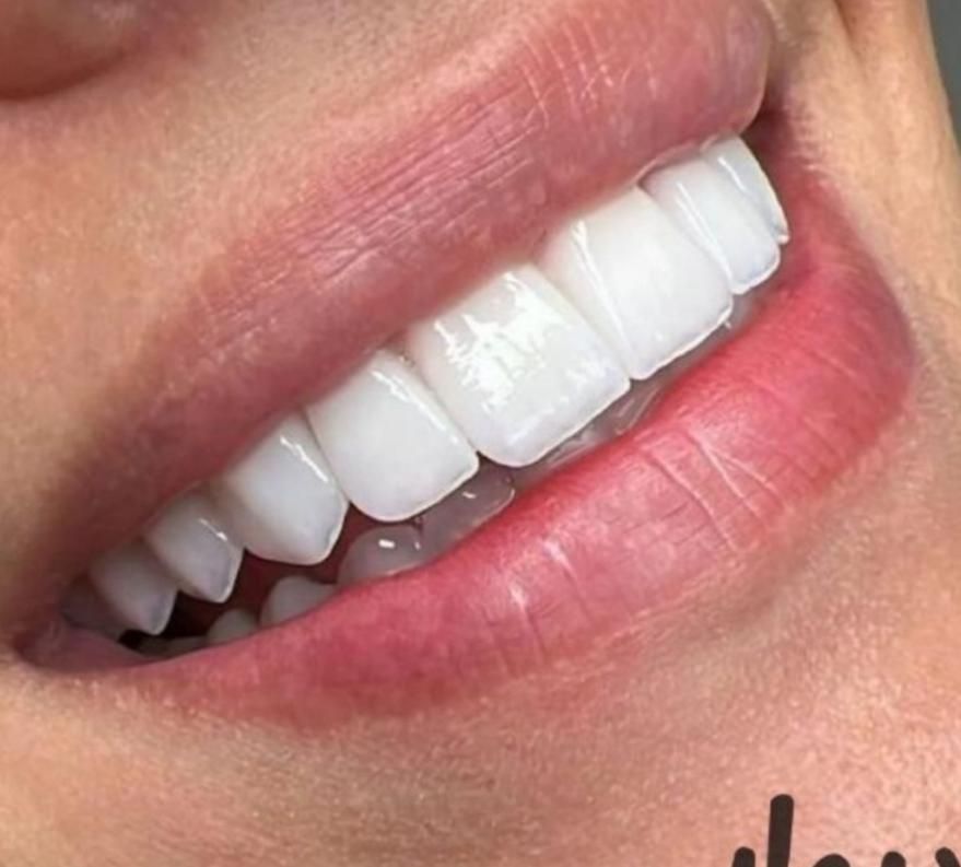 دندان مصنوعی|خدمات آرایشگری و زیبایی|اردبیل, |دیوار