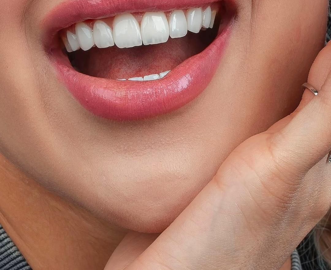 کامپوزیت دندان لیانا همراه با شرایط|خدمات آرایشگری و زیبایی|تهران, نارمک جنوبی|دیوار