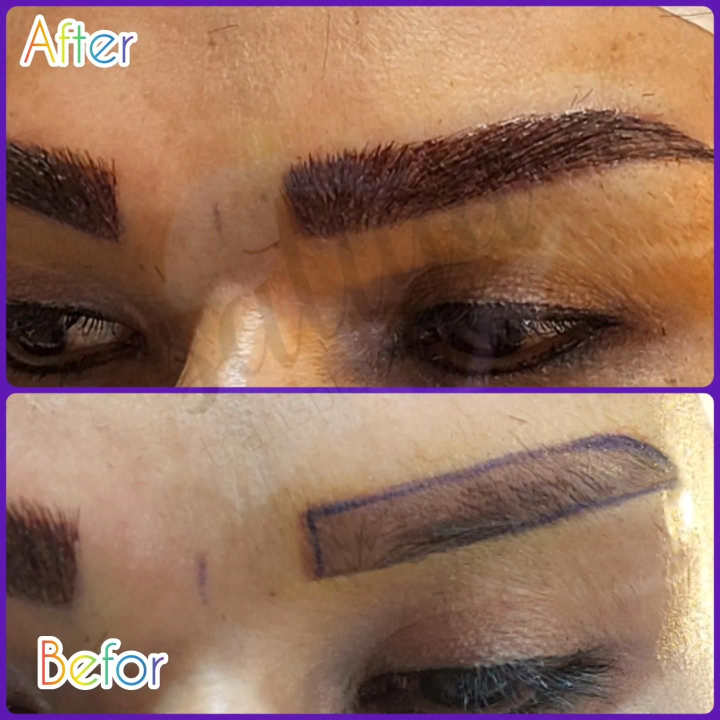 پیوند مو و ابرو در تهران در کلینیک معتبر|خدمات آرایشگری و زیبایی|کاشان, امیرکبیر|دیوار