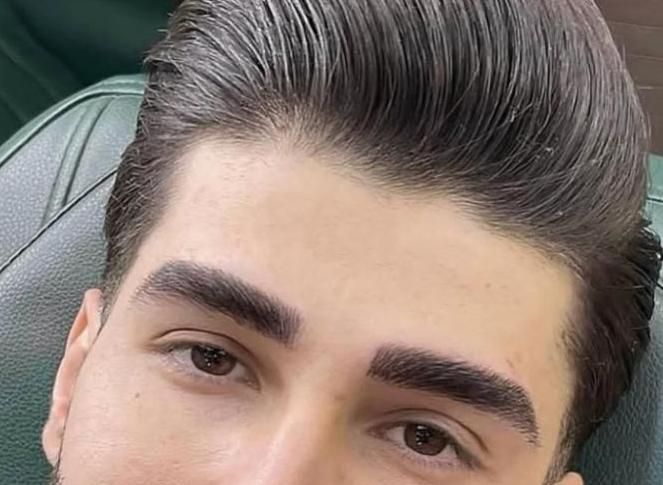 رفع تیرگی لب ،شیدینگ لب ،اسکالپ موی سر آقایون|خدمات آرایشگری و زیبایی|زاهدان, |دیوار