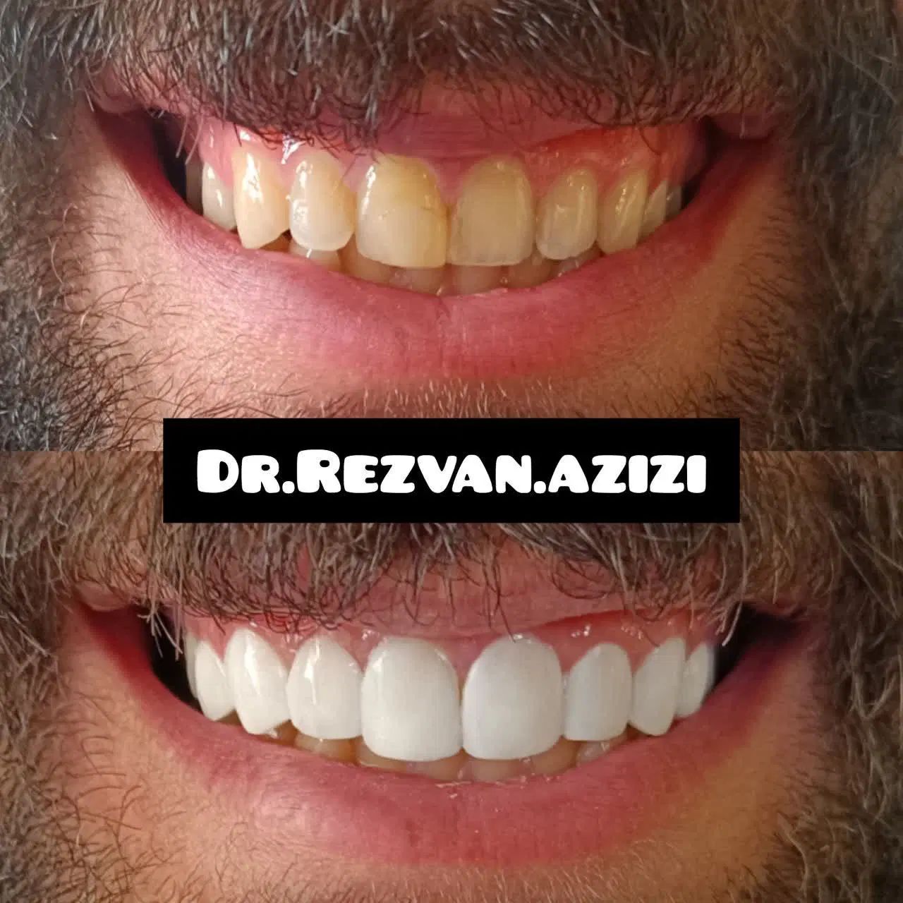 جشنواره بزرگ عصبکشی دندان برای اولین بار|خدمات آرایشگری و زیبایی|شیراز, سینما سعدی|دیوار