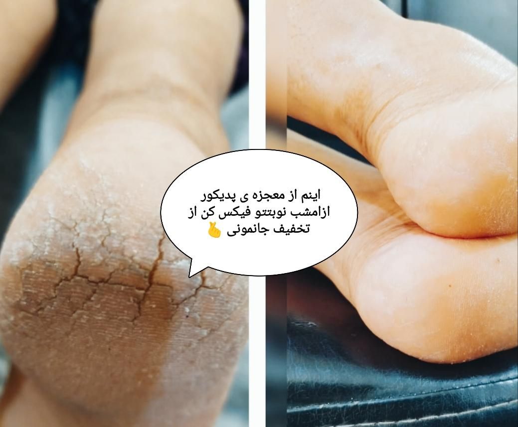 پدیکور|خدمات آرایشگری و زیبایی|سنقر, |دیوار