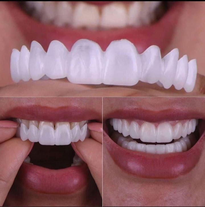 لمینت دندان و پرداخت درب منزل و|آرایشی، بهداشتی، درمانی|تهران, آجودانیه|دیوار