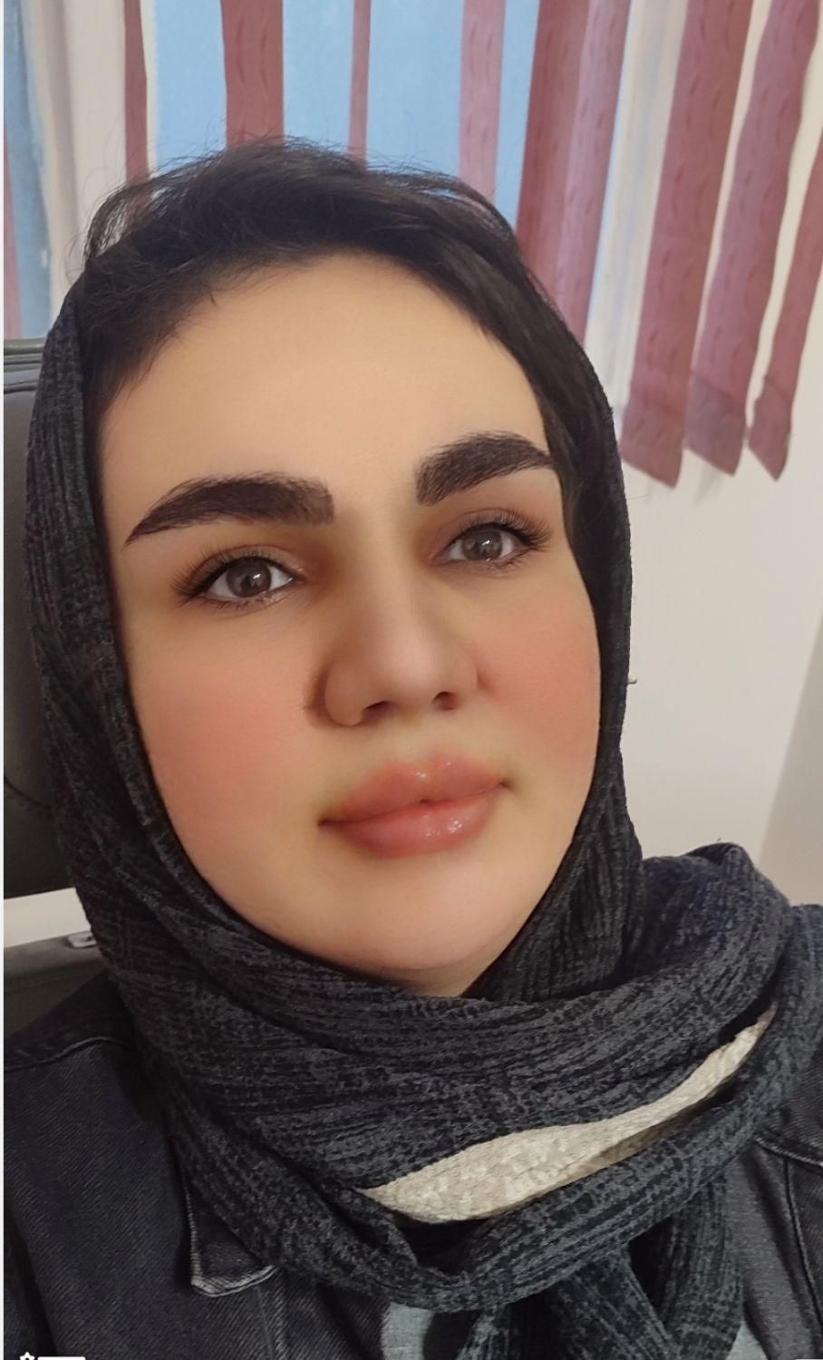 تزریق ژل بوتاکس فیلر تخفیف ویژه|خدمات آرایشگری و زیبایی|تهران, سبلان (لشگر)|دیوار