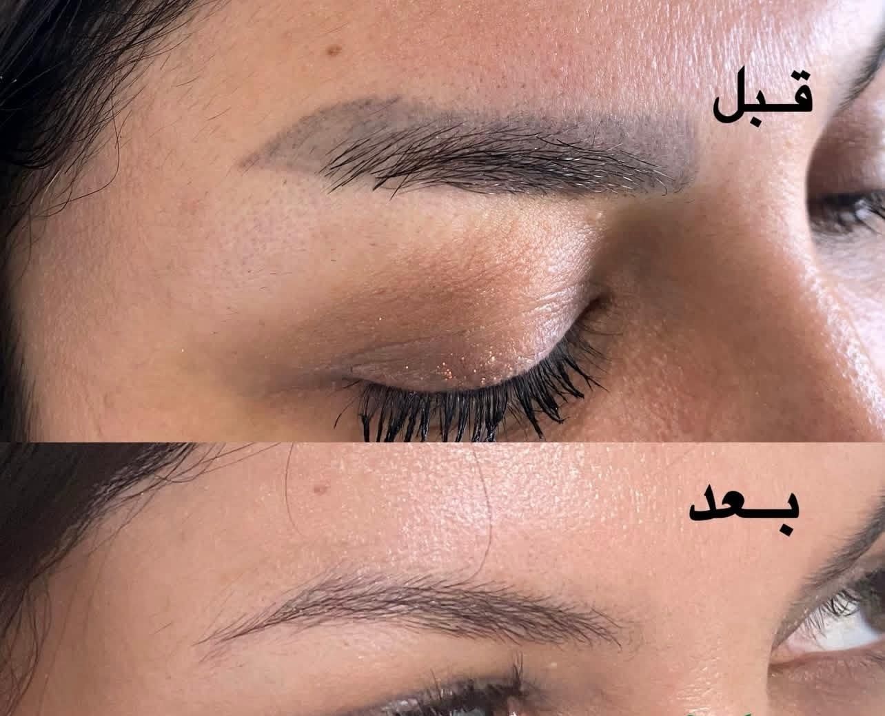 پاک کردن انواع تاتو با لیزر پیشرفته کیوسوئیچ|خدمات آرایشگری و زیبایی|اهواز, کیانپارس |دیوار