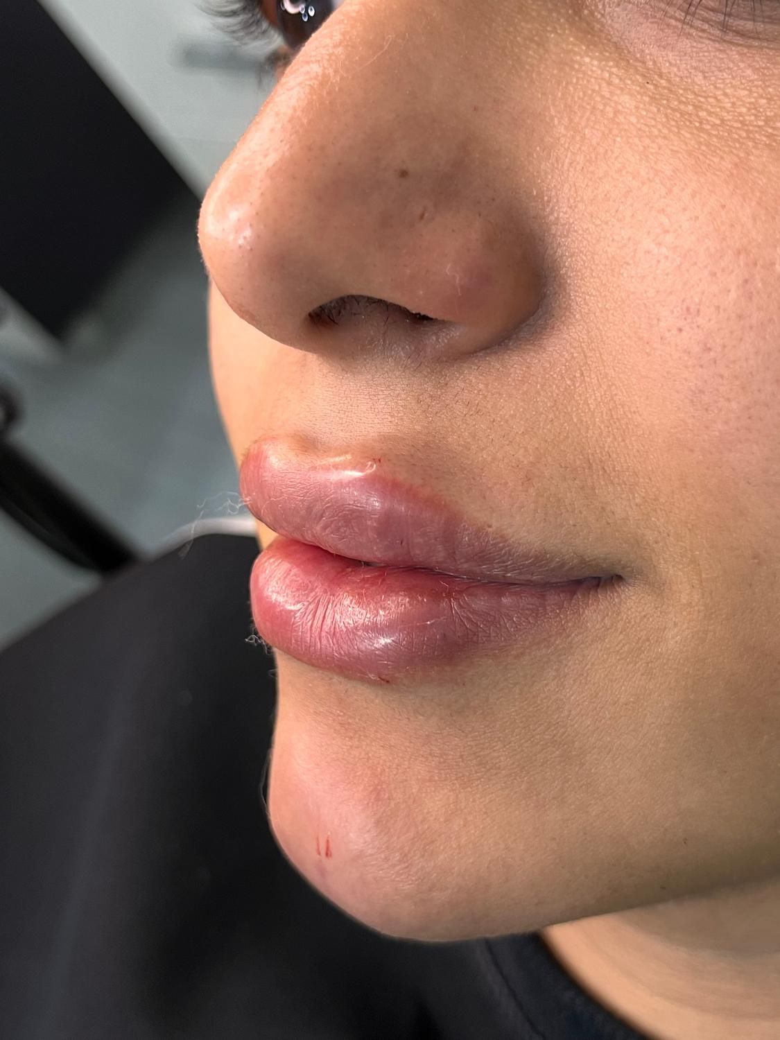 مدل ژل و بوتاکس|خدمات آرایشگری و زیبایی|اصفهان, شهرک کاوه|دیوار